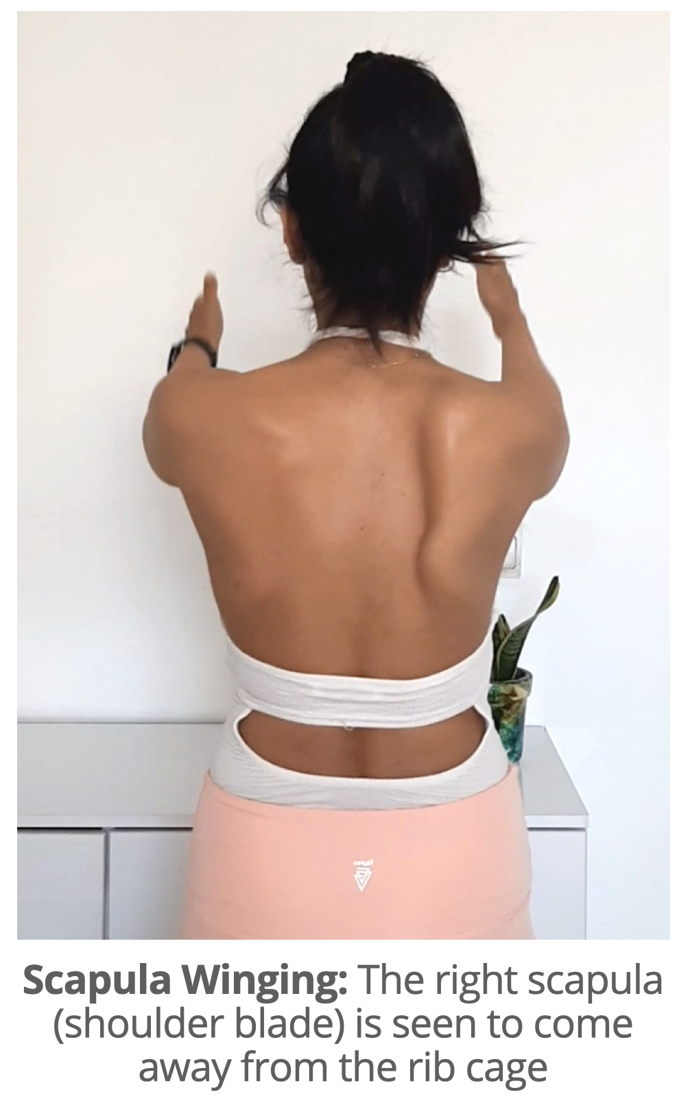 Article Scapula Winging