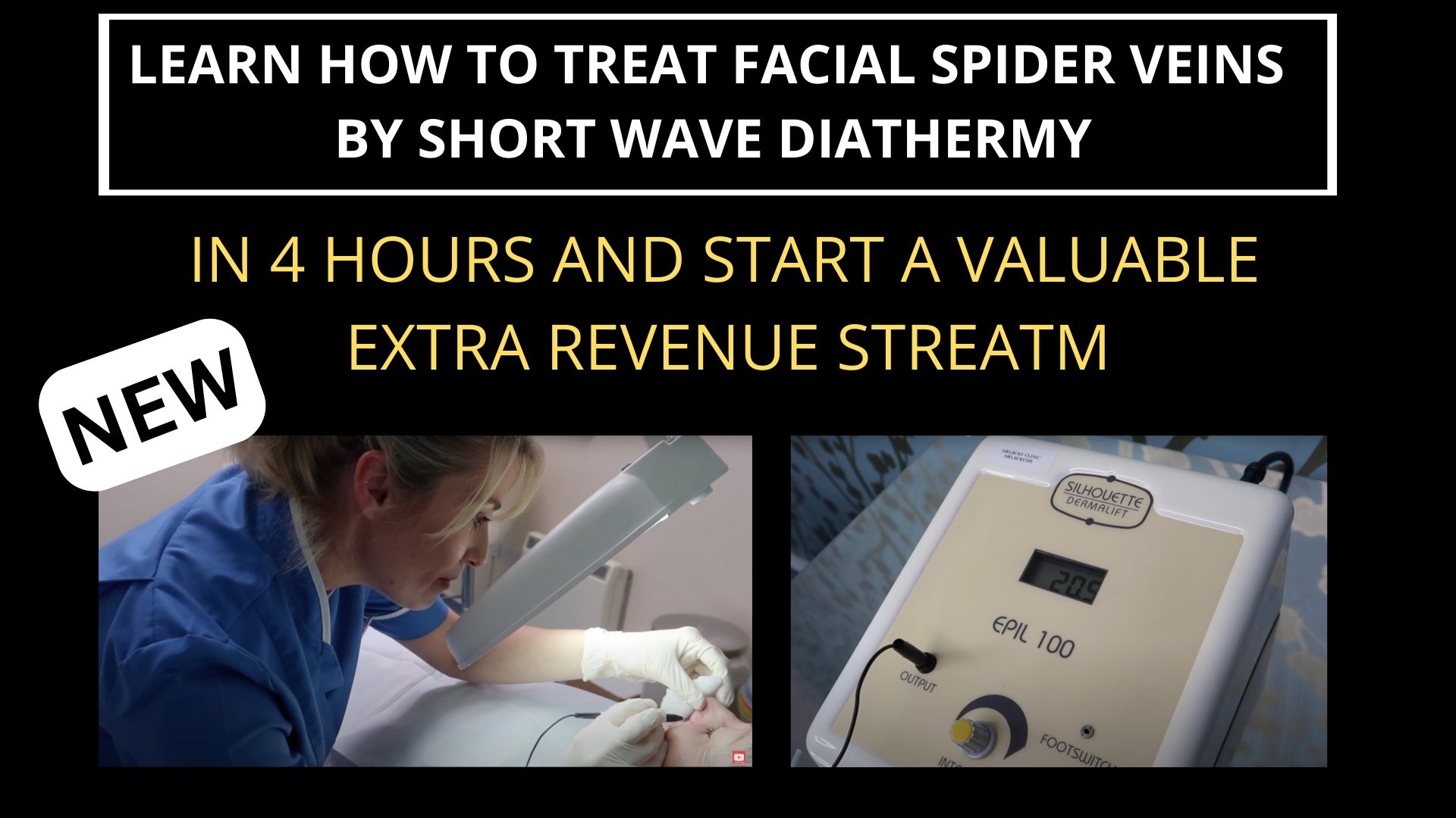 Learn How To Treat Facial Spider Veins by Short Wave Diathermy